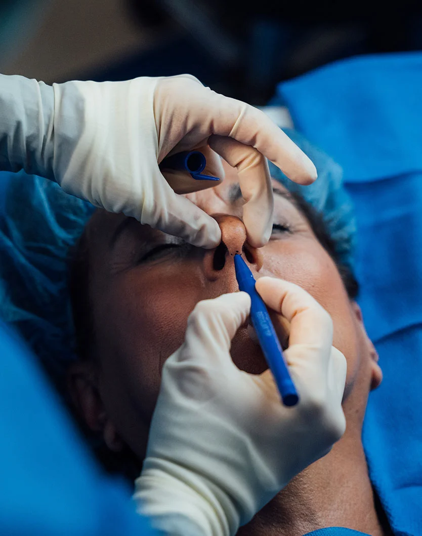 nasal-reconstruction-intro