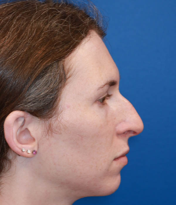1_0002_R lateral.jpg