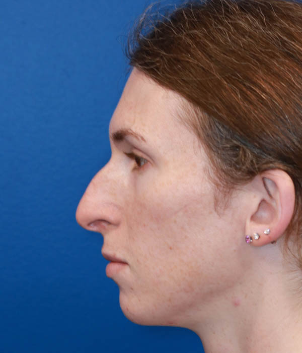 1_0004_L lateral.jpg